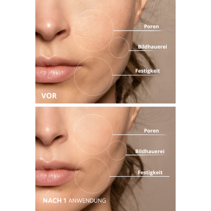 PEAU PURE 7-in-1 LED Facial Sculptor